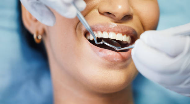 Best Emergency Dentist for Knocked-Out Tooth in Melbourne Beach, FL